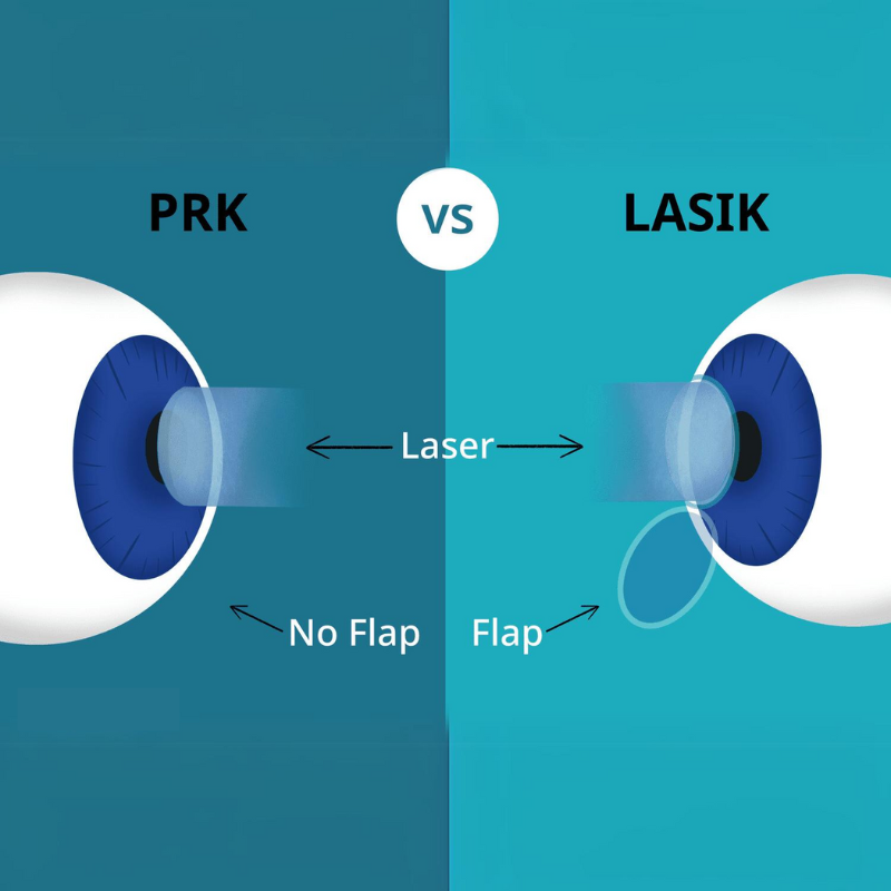 Chirurgie oculaire au laser : Quelles maladies peut-on traiter et lesquelles sont exclues ?